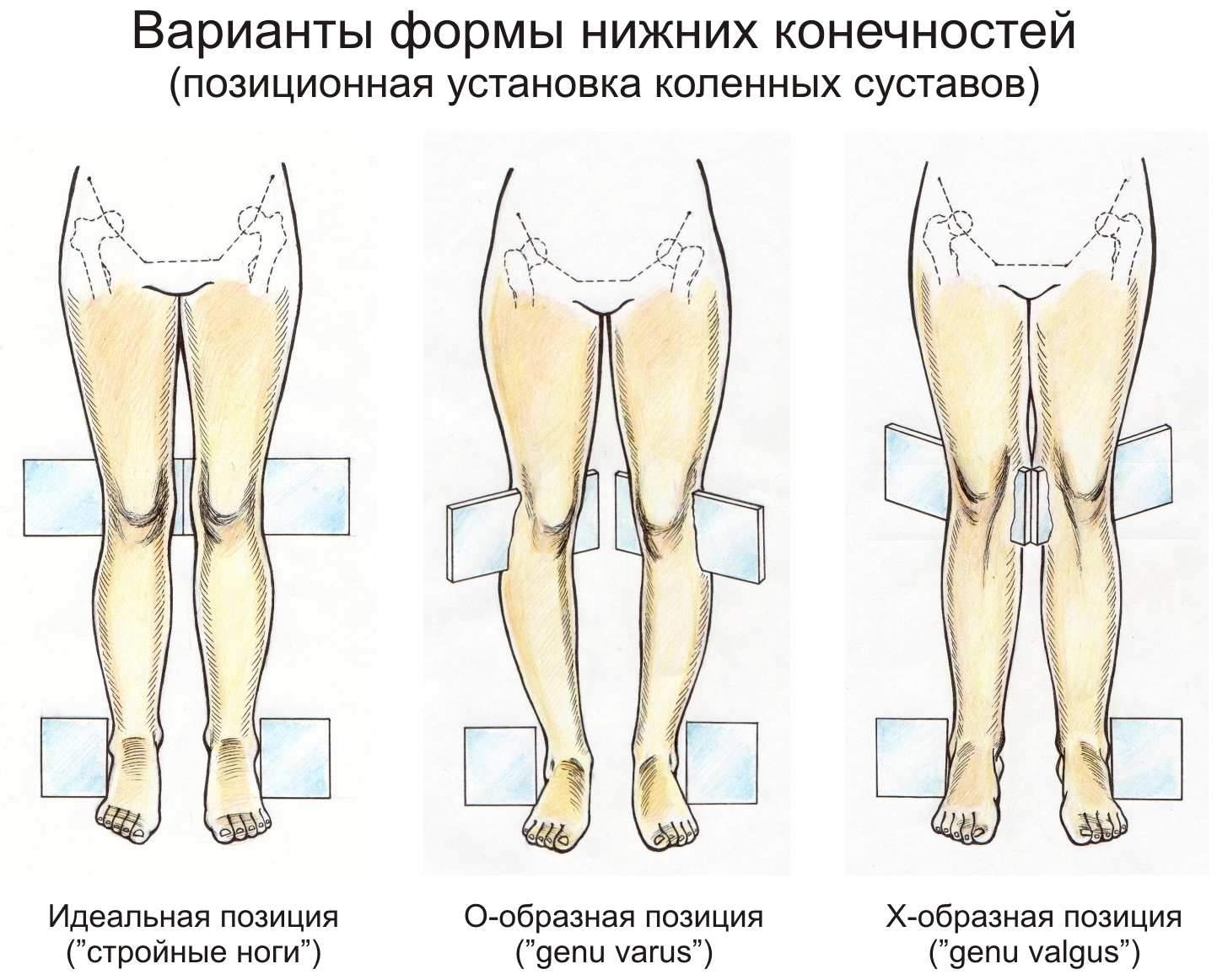 позиционная установка коленных суставов